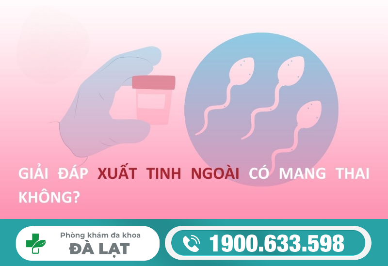 Hình ảnh minh họa